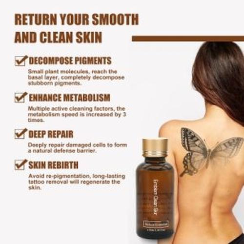 30Ml Safe Permanent Tattoo Removal Liquid