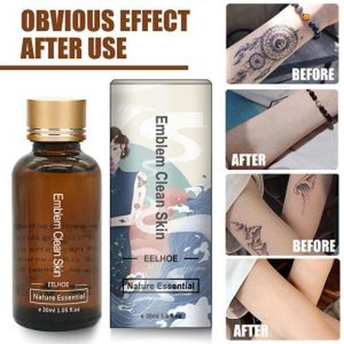 30Ml Safe Permanent Tattoo Removal Liquid