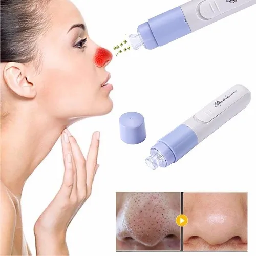 Blackheads Vacuum