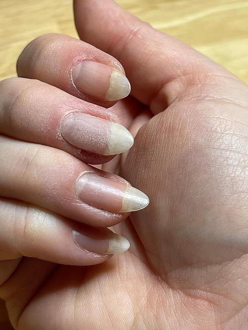 Nail Repair Gel - Cracked Nail Repair Gel Strengthen Long Lasting Harmless For Uv Acrylic Broken Nails Gel photo review