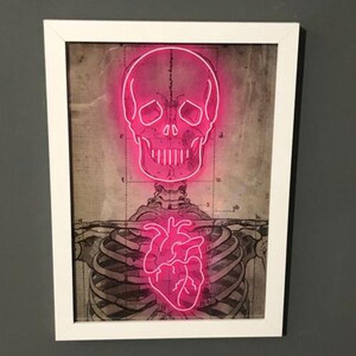 Neon Skeleton Vintage Diagram Art Print - Affiche médicale photo review