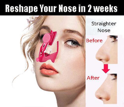 Painless Electric Nose Lifter &amp; Straightener