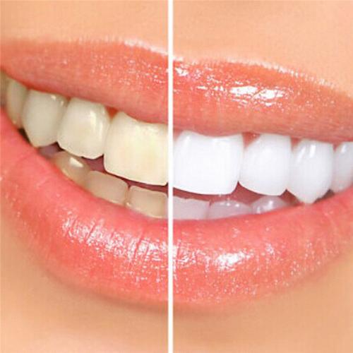 Perfect Teeth Whitening Pen Beauty Toothbrush Clean Toothpaste Gel