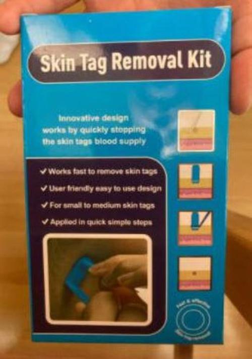 Skin Tag Removal Device, Meat Mole Removal, Corn Removal photo review