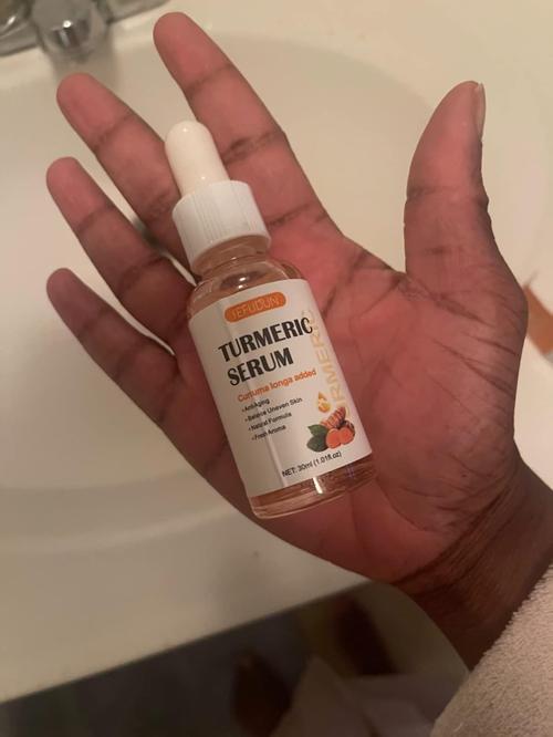 Turmeric Dark Spot Corrector Serum photo review